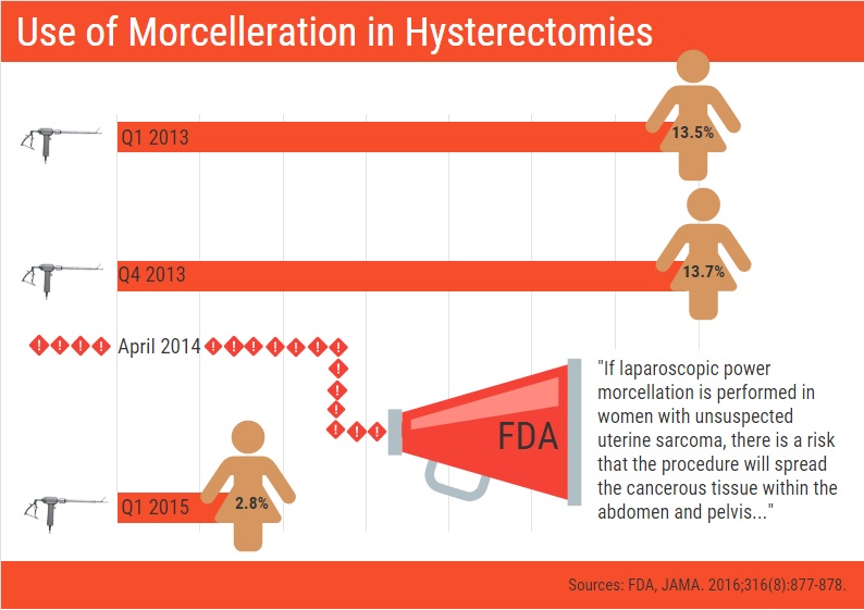 Morcellation_infographic.jpg