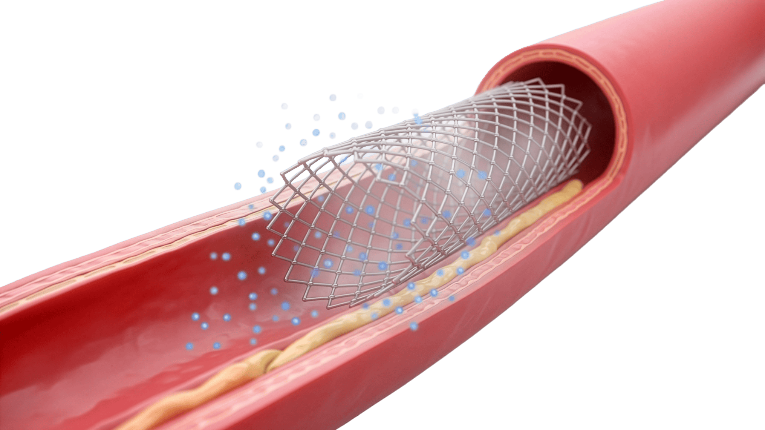 image of stent eluting drugs