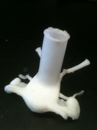 Hydrogel Uterus Model