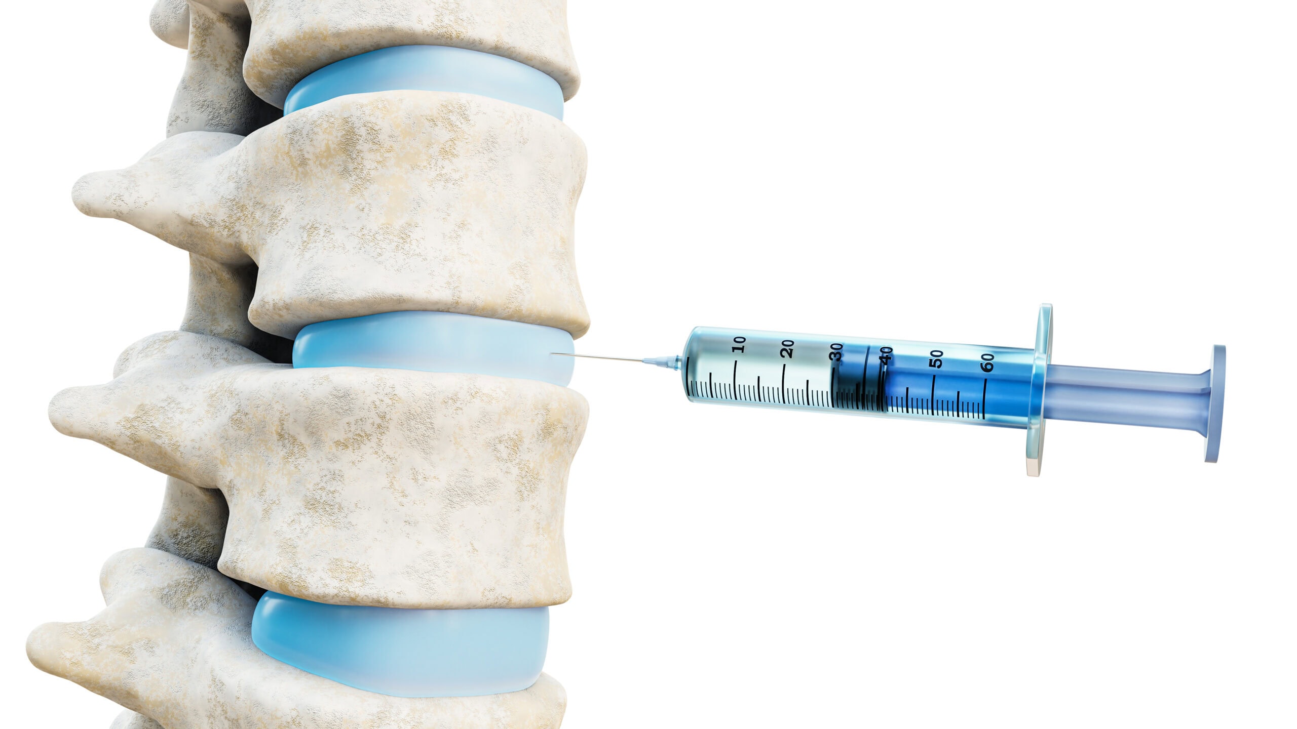 Injectable Hydrogels