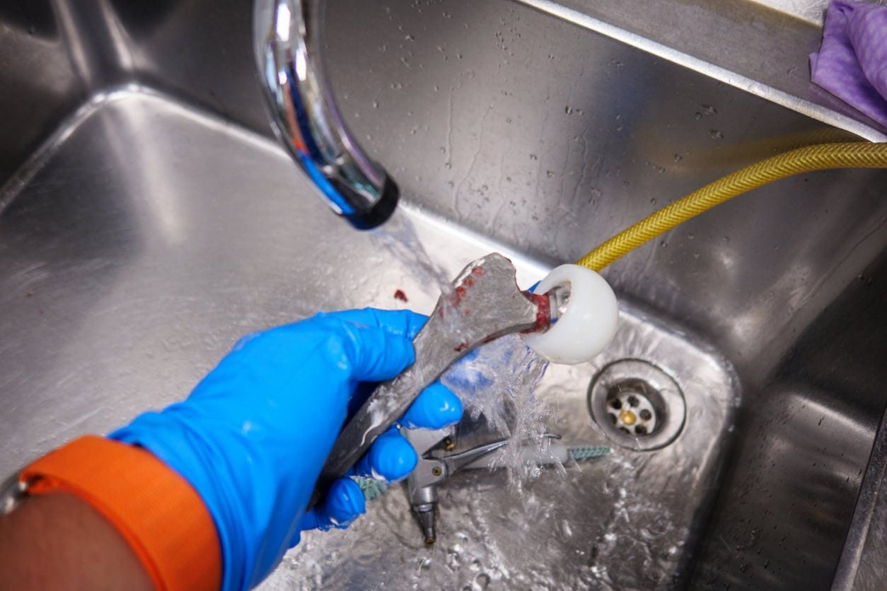 a explanted hip prosthesis is cleaned after surgery
