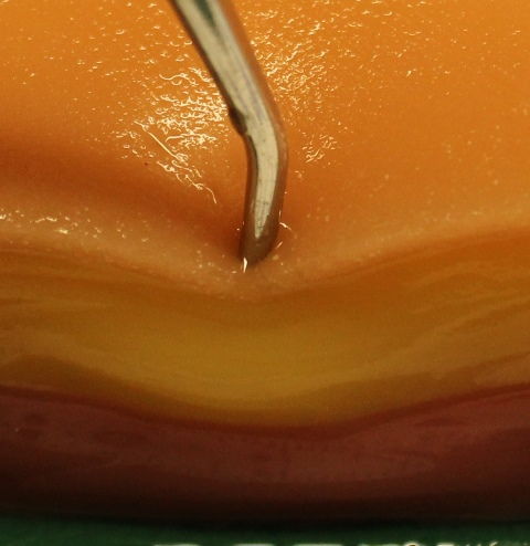 Skin Hydrogel